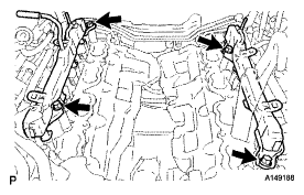 G04947874