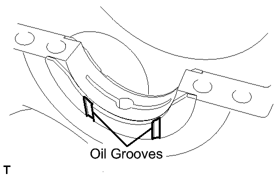 GTY145389