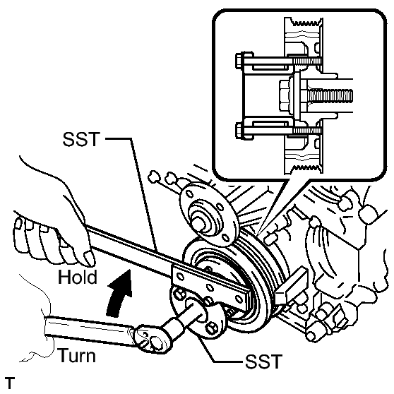 GTY146076